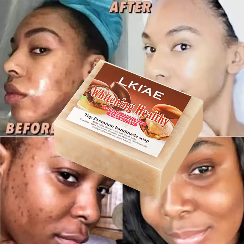 Organic Fresh Milk Whitening Soap Bar, Lighten, Improve Skin Elasticity, Handmade Soap for Face, Body and Hands, 150G/5.3 Oz